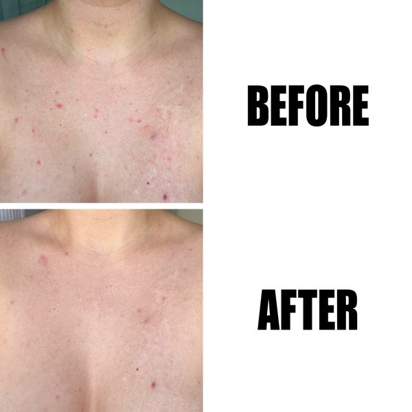 The INKEY List The INKEY List Glycolic Acid Exfoliating Body Stick 45g Novità