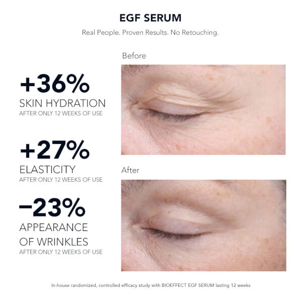 BIOEFFECT BIOEFFECT EGF Serum 15ml In vendita