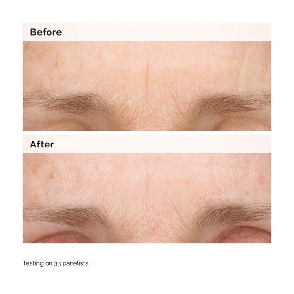 The Ordinary The Ordinary Retinal 0.2% Emulsion 15ml Enormi risparmi