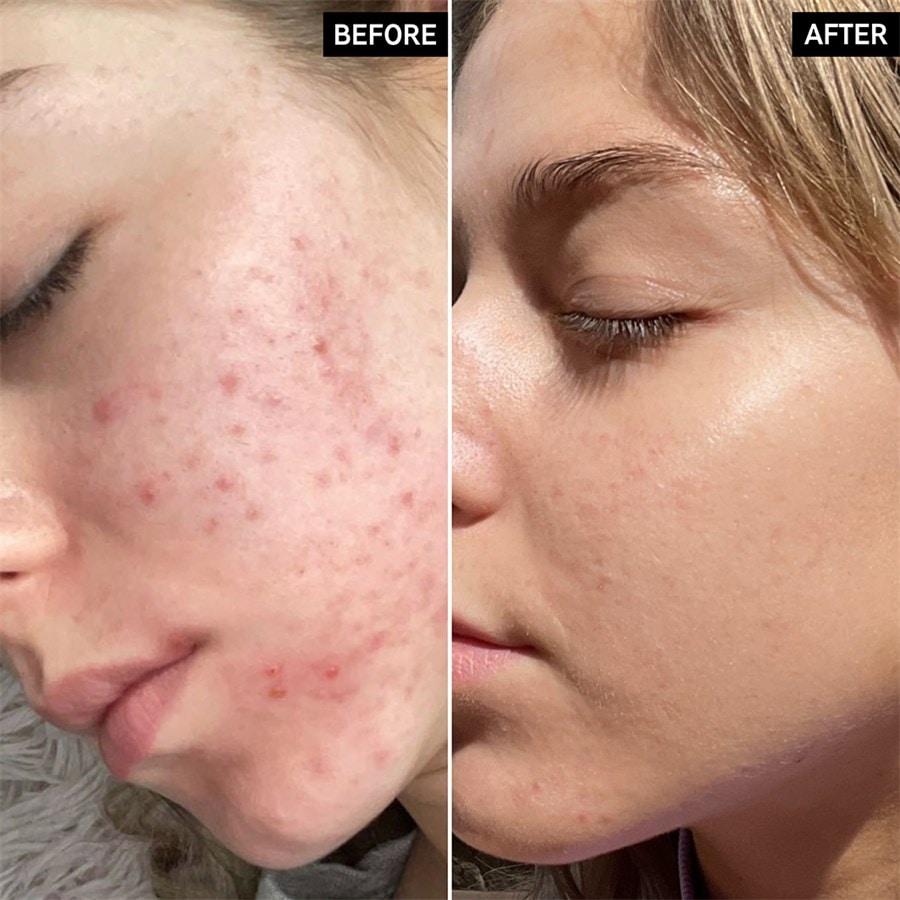 The INKEY List Sieri Niacinamide Serum Shopping online