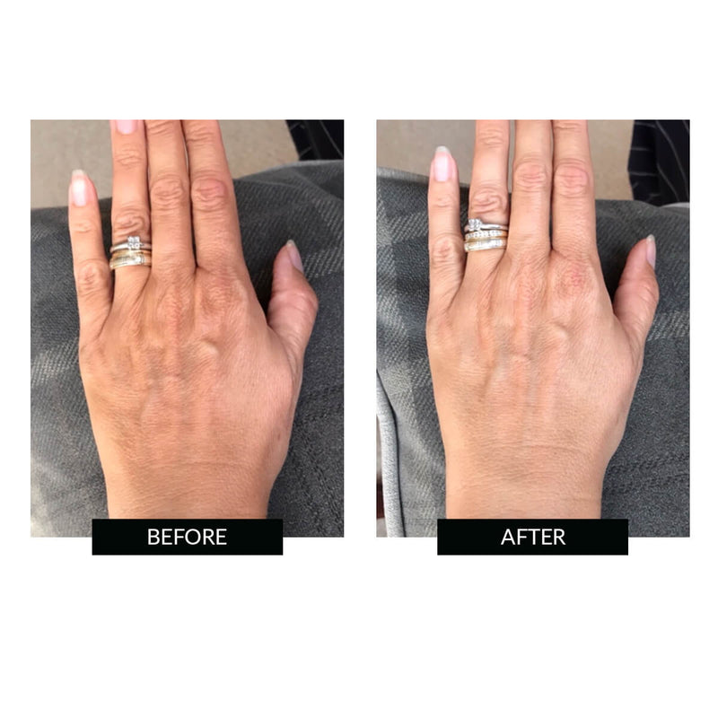 CurrentBody Skin Offers CurrentBody Skin LED Hand Perfector Offerta Vendita