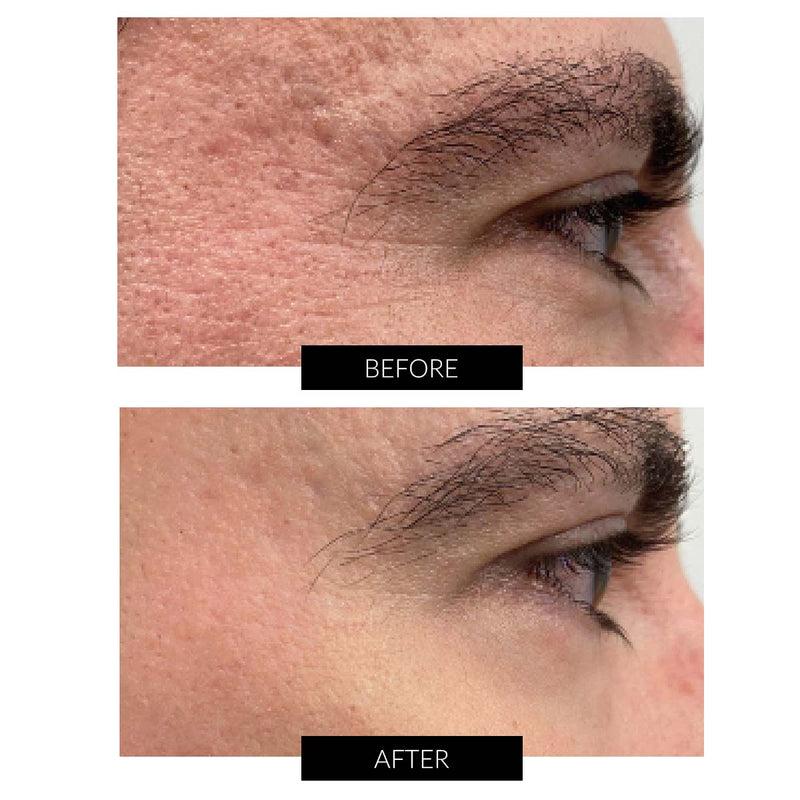 Dr Levy Set Stem Cell Miracle Trial (del valore di 495€) Smaltimento dello stoccaggio