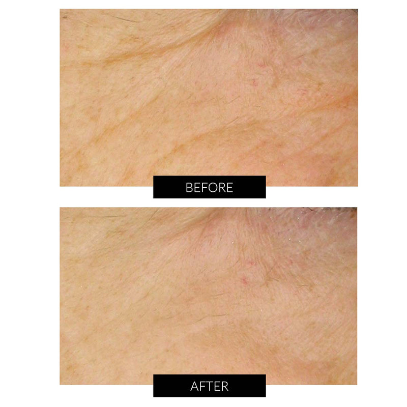 Dr Levy Set Stem Cell Miracle Trial (del valore di 495€) Smaltimento dello stoccaggio