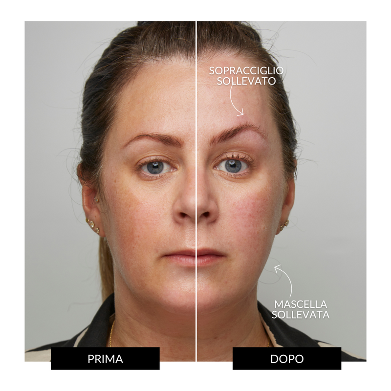 CurrentBody Skin Offers Dispositivo Tonificante Facciale ZIIP HALO Offerta Ritorno libero