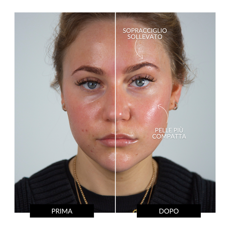 CurrentBody Skin Offers Dispositivo Tonificante Facciale ZIIP HALO Offerta Ritorno libero