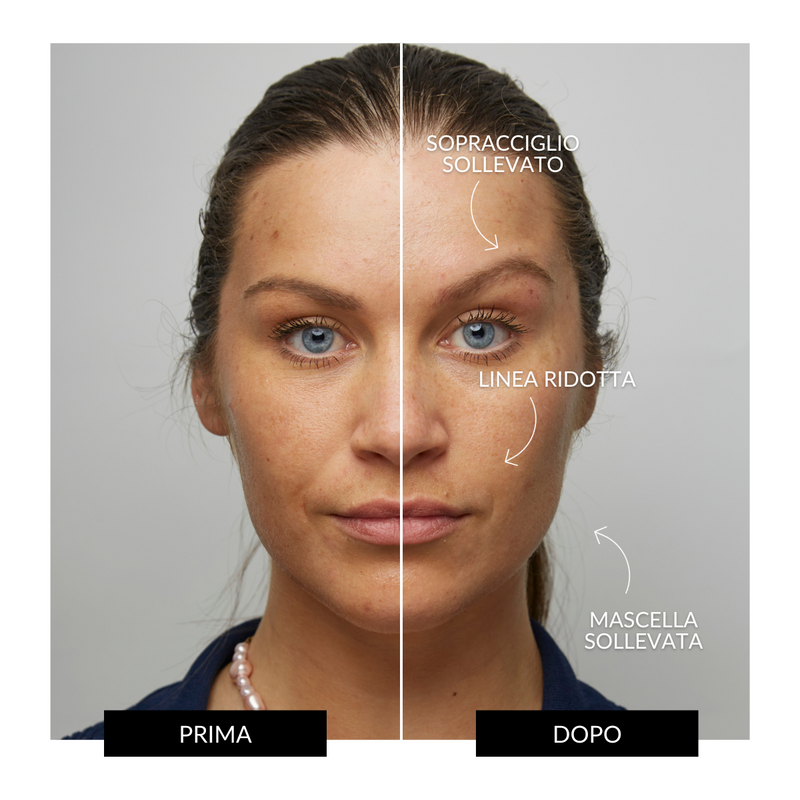 CurrentBody Skin Offers Dispositivo Tonificante Facciale ZIIP HALO Offerta Ritorno libero